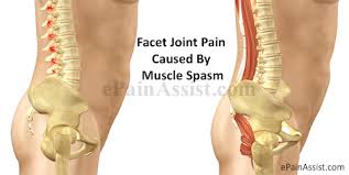 Image result for pictures for joint problems