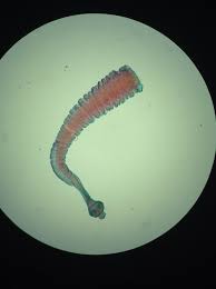 Taenia Solium Sp Under L P O Cutie Haha Microbiology Parasitic Worms Class Notes