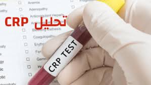 وظائف الكبد تحاليلي