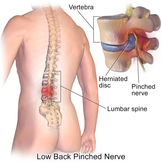 Person experiencing severe lower back pain