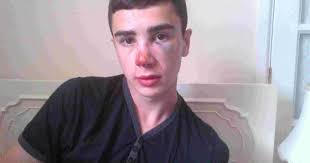 "I feared I would die", says teenager beaten unconscious by gang of twenty 