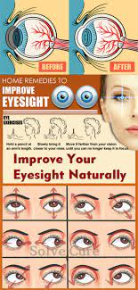 Improve Your Eyesight Naturally Solve Cure Eye Exercises Eye Sight Improvement Eye Care