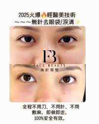 係咪有淚溝/眼袋問題❓, 化妝又煩，唔化妝仲煩❓, 做手術又驚‼️打針又驚‼️, 2025火爆🔥輕醫美技術, ～～～無針去眼袋/淚溝✨,  完成即時已見到效果！, 更加可以keep 3-5年！, 無針納米導入復合膠原蛋白及復合多肽（與人體細胞同源產品，100%安全）達到祛眼袋/淚溝效果。,  全程不用刀、不用針、不用敷麻，即做即走，100%安全有效。, ️#無針微整 #多肽逆齡筆 #豐鼻 #高鼻 ...