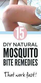 Bug Bites That Look Like Mosquito Bites But Hurt Pin On Outdoor Tips