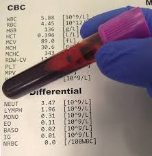 Complete Blood Count Wikipedia