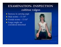 Image result for Elbow Exam