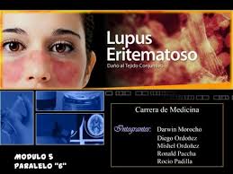 Sindrome coronario agudo