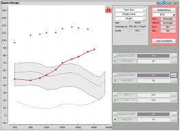 Speechmap As A Counseling And Fitting Tool Dave Smriga