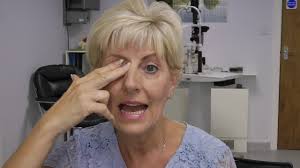 Endonasal DCR patient talking about her experience before undergoing stent  removal