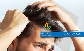 حقن البلازما للشعر كيف تعاج تساقط الشعر مركز فلوريا Florya