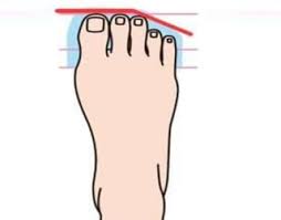 7 Types Of Toes And The Secrets They Reveal About Your