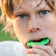 5 Points for Wearing a Mouth Guard During Sports: