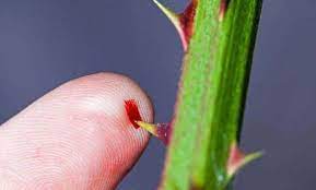 Software to learn languages quickly. Thorn Pricking Can Give You Infection Know Home Remedies To Treat It Effectively Newstrack English 1