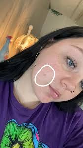 Can I remove blemishes from my item myself?