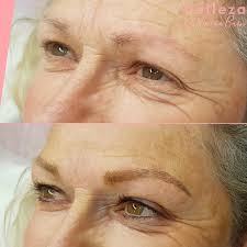 Before and After's for Microblading — Belleza
