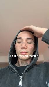 Overcoming Balding Fears: How to Embrace Your Inner Confidence