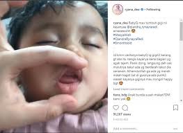 9 obat gusi bengkak karena tumbuh gigi pada anak. Gambar Gusi Bayi Yang Mau Tumbuh Gigi Tempat Berbagi Gambar