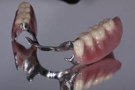 Browse 947 upper denture stock photos and images available, or start a new search to explore more stock photos and images. Metal Based Partials Williams Dental Lav