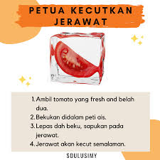 Jerawat bukan hanya pada anak remaja sahaja. Soulusi Petua Time Kecutkan Jerawat Apa Kata Dari Facebook