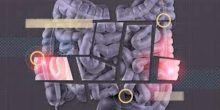 General signs of throat cancer may include the following: Referral Of Patients With Features Suggestive Of Bowel Cancer Ministry Of Health Guidance Bpac Nz