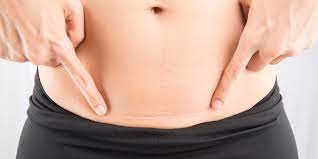 14 pre diabetic fruits to avoid range (⭐️ zhongwen) | pre. Things You Need To Know About First Period After C Section What To Expect Cloudnine Blogthings You Need To Know About First Period After C Section