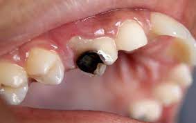 Maybe you would like to learn more about one of these? Hyde Park Dental Clinic London Dentists Creative Dentistry