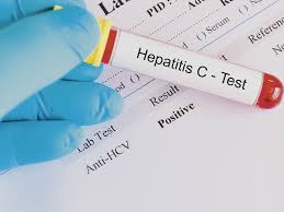 Doctorul va realiza un examen fizic pentru a vedea dacă există semne ale inflamației ficatului (de exemplu, îngălbenirea pielii sau dureri. Romania Isi Propune SÄƒ Eradicheze Hepatita B Si Hepatita C PanÄƒ In 2030 Romania Libera