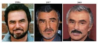 Burt reynolds plastic surgery can be described in one word …. Burt Reynolds Plastic Surgery