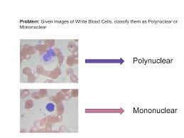 Classifying White Blood Cells With Deep Learning Code And