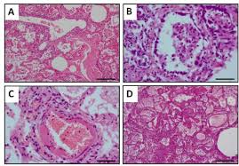 Pneumonia can be mild and only require a week of treatment before you can. Humoral Response To Sars Cov 2 By Healthy And Sick Dogs During Covid 19 Pandemic In Spain Biorxiv