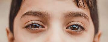 Check spelling or type a new query. What Is Lazy Eye