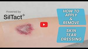 Image result for Skin Tear