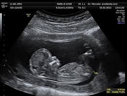 Pain in the abdomen, what to do in this situation, how to relieve the suffering of the child, how to effectively help him. Spanish Study Shows 16 Week Old Fetuses Sing And Dance To Music In The Womb