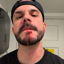 Fundraiser by Paul Smith Jr : Help Steve offset Medical Expenses from  Assault