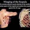 Sprengel deformity typically occurs sporadically for no apparent reason but autosomal dominant inheritance has been reported. 1