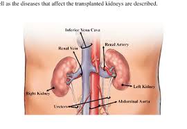 Each kidney is of a characteristic shape, having a superior and an inferior pole, a convex border placed laterally, and a concave medial border. The Abdominal Area Of The Human Body Showing The Kidney Location 15 Download Scientific Diagram