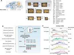 This game is developed for ios devices and it becomes famous in mind games. An Anatomically Resolved Mouse Brain Proteome Reveals Parkinson Disease Relevant Pathways Molecular Cellular Proteomics