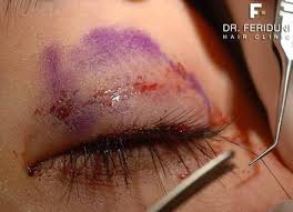 Maybe you would like to learn more about one of these? Eyelashes