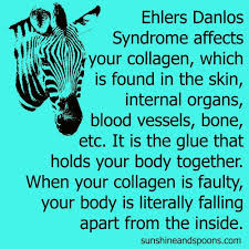 Pin By Deirdre Keane On Eds Syndroom Van Ehlers Danlos Fibromyalgie Ehlers Danlos Syndrome Hypermobility Ehlers Danlos Syndrome Awareness Ehlers Danlos Syndrome