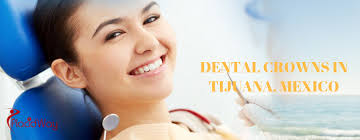 Top Dentists in Tijuana for Affordable Dental Crowns