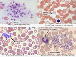 Haematology in a NutShell: Platelet Clumps