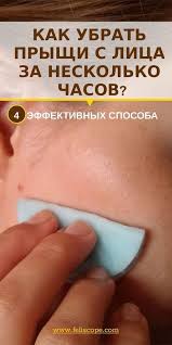 как избавиться от прыщей в домашних условиях за один день Kak Ubrat Pryshi S Lica Za Neskolko Chasov 4 Effektivnyh Sposoba Chistoe Lico Lico Sredstva Protiv Pryshej