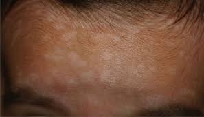 Panau is a genus of moths in the cossidae family. Panau Qualitas Health Klinik Medivalle Glo Damansara Facebook
