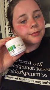 Hi dear group😍 What is the VERY best instant relief for sunburn? Is it  just aftersun? Tia❤️❤️