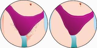 Dae One Style The Importance Of Exfoliating Before Shaving Bikini Bump Shaving Bikini Area Bikini Hair Removal