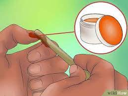 How To Remove A Splinter Under Your Fingernail Splinter Removal Fingernails Splinter Under Fingernail