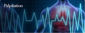 Palpitation Heart Palpitation Ruth Kam Heart Arrhythmia Clinic