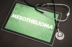 Learn about the steps involved with filing a claim. How Do You Go About Making A Mesothelioma Claim Mooneerams