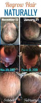 But even in women who have never resorted to this procedure, after the winter or hot summer, the hair becomes dry and loses its natural shine. Before After Pics 2 Products Uses To Regrow Hair For Men Regrow Hair Regrow Hair Naturally Natural Hair Growth