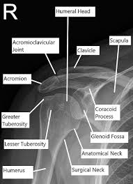 Start studying shoulder impingement syndrome. Shoulder Impingement New York Shoulder Surgeon